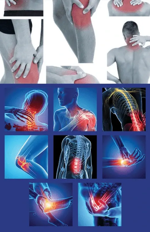 Cedera olahraga yang ditangani sport massage MCO Jakarta